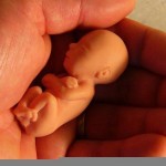 Image for Сенсационное признание главврача. «Аборт — это выгодно всем» (ВИДЕО)